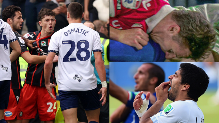 Luis Suarez, Paul Mullin & Milutin Osmajic! Liverpool loanee Owen Beck shown red card in biting incident despite being victim in ugly Preston vs Blackburn derby clash that leads to calls for ‘massive ban’